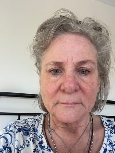 Customer photo review of The Complete System for Mature Women’s Skin