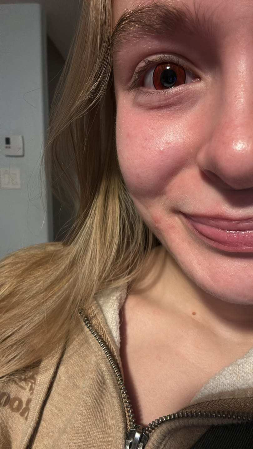 Customer photo review of PRIMAL ® Dracula I - Red Colored Contact lenses