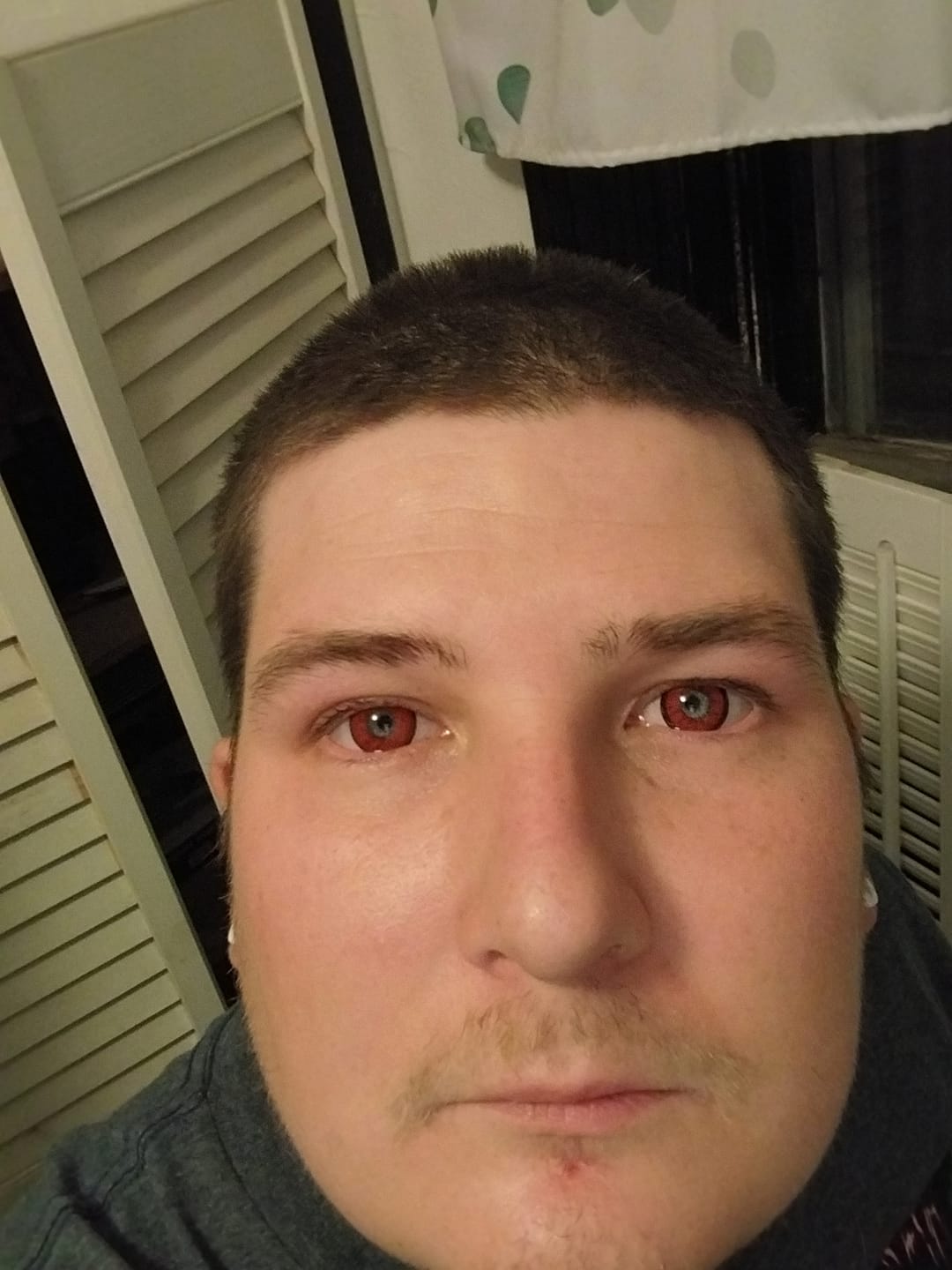 Customer photo review of Cosplay ICE Red Prescription Colored Contact Lenses
