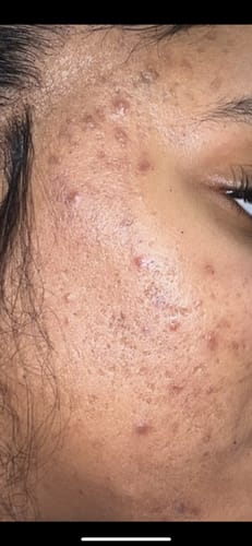 Customer photo review of LIMITED EDITION KIT Jolie’s Mini Full Body & Face Brightening Kit
