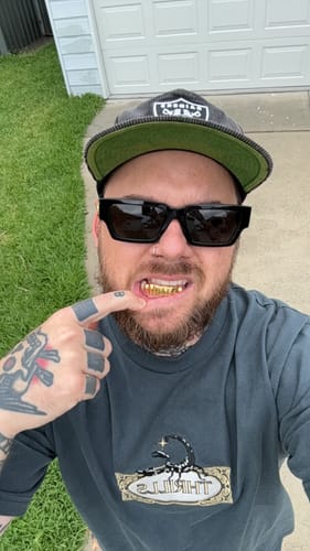 Customer photo review of SCORCH (GOLD PLATED GRILLZ)