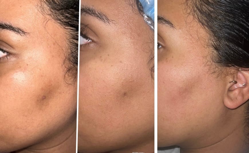 Customer photo review of Jamila Kojic Soap