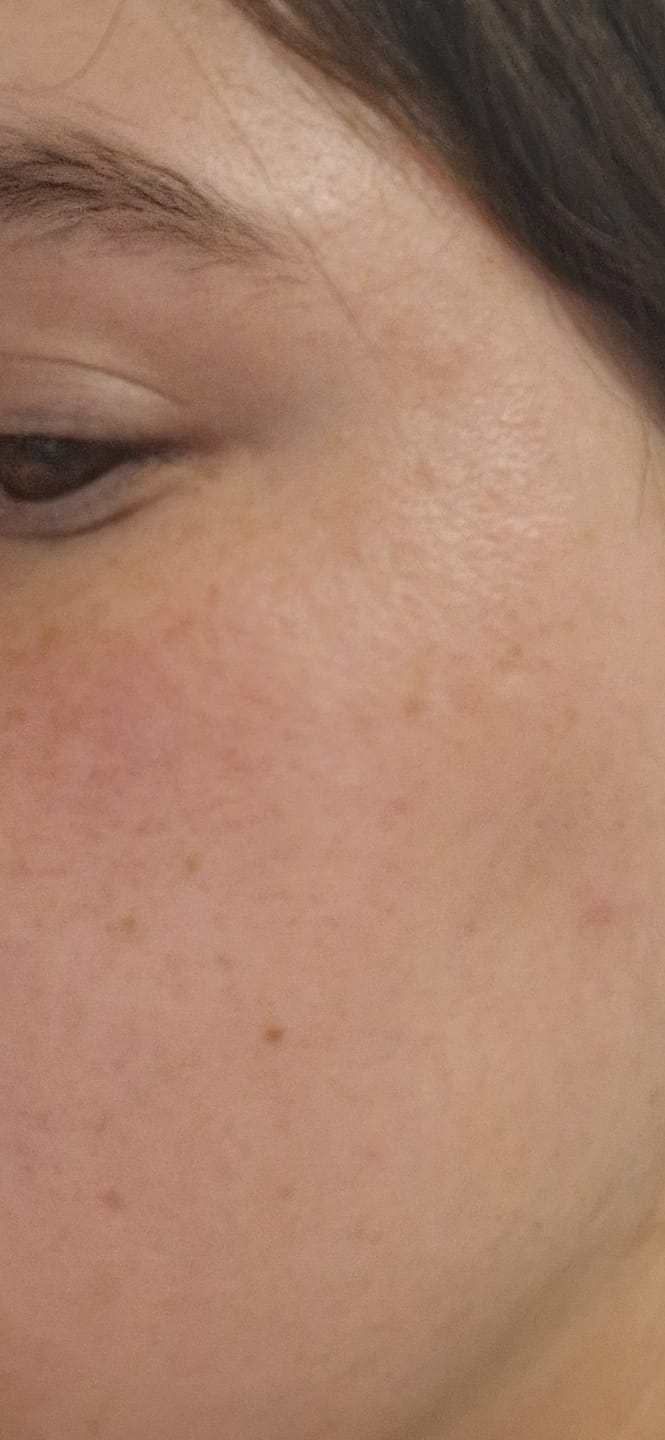 Customer photo review of Peptide + Probiotic Face Cream (New and Improved)