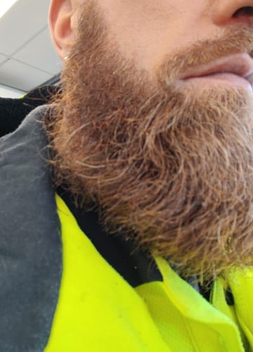 Customer photo review of Rosemary & Castor Oil for Hair Growth