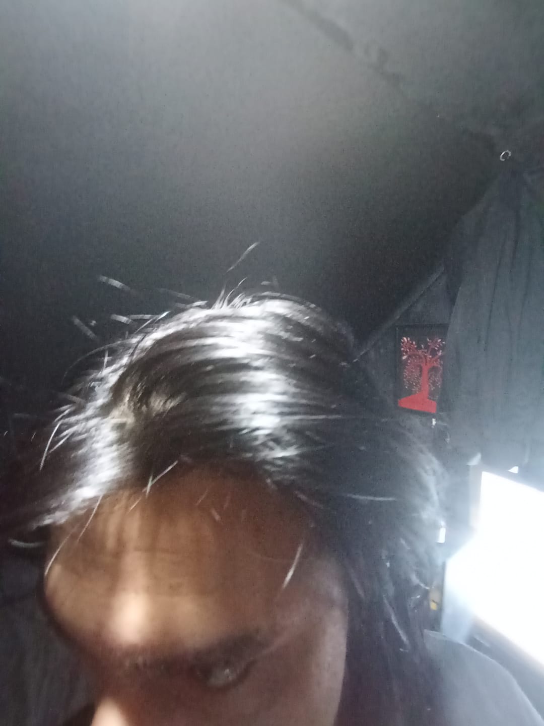 Customer photo review of Pack Anticaída de Cabello para 1 Mes