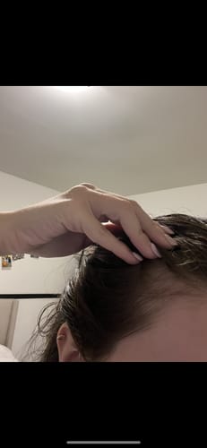 Customer photo review of Pre-Wash Scalp Oil by TR