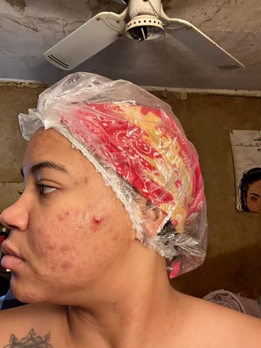 Customer photo review of 2-1 Double Cleansing Exfoliant