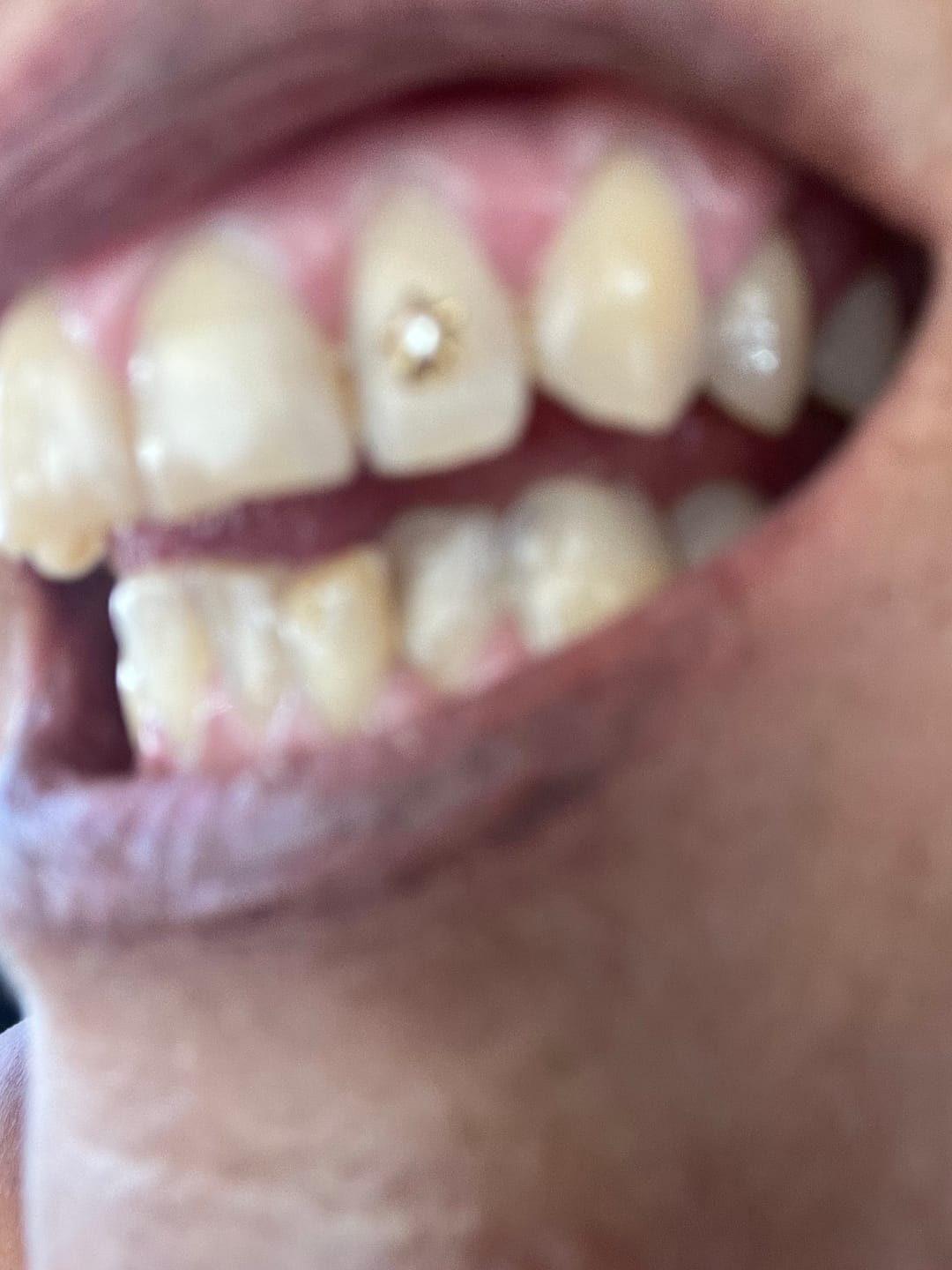 Customer photo review of Star w. Diamond 22-karat gold