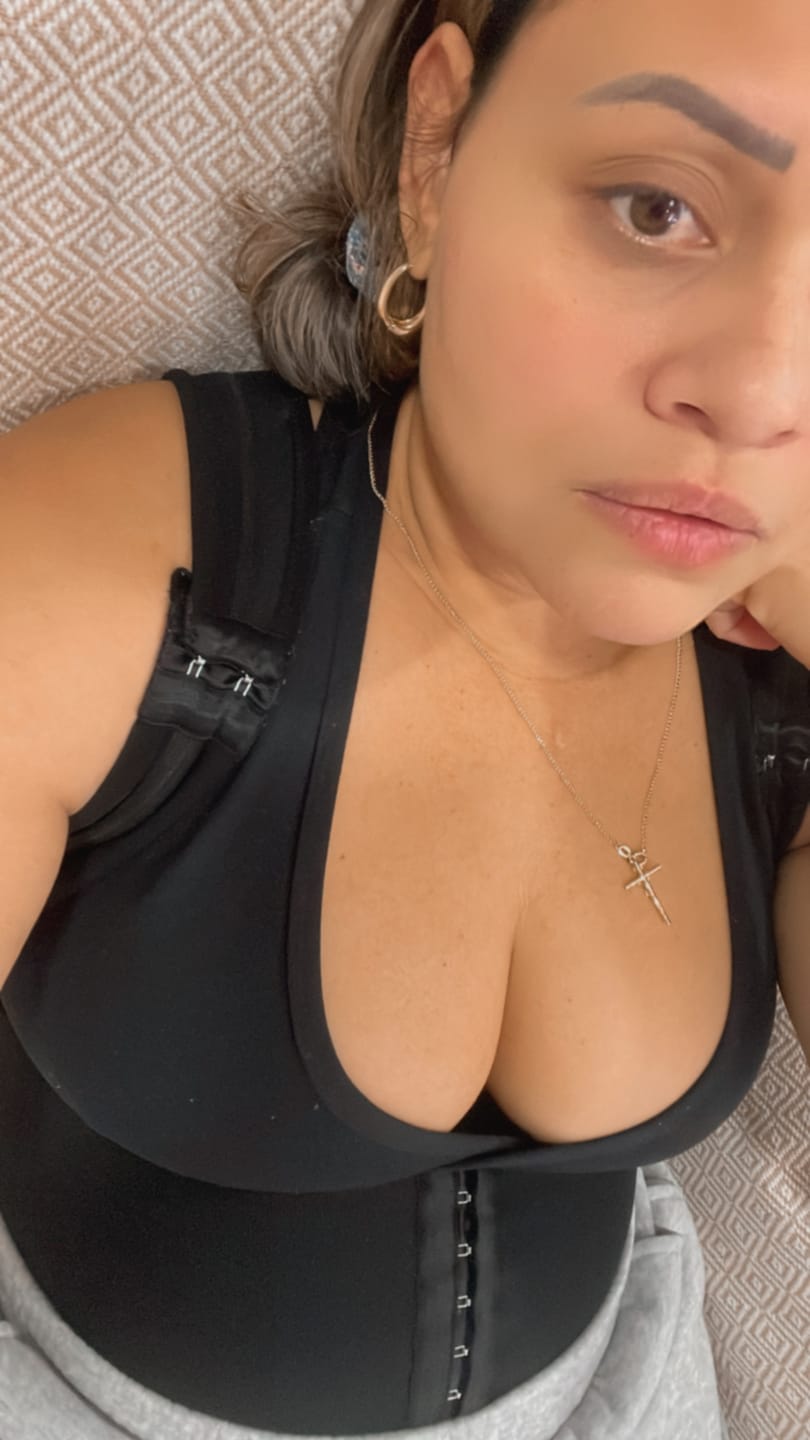 Customer photo review of TABLA ABDOMINAL ESTILO MARIPOSA APLANAR VIENTRE LIPOSUCCION ABDOMINOPLASTIA CIRUGIA ESTETICA POST-PARTO