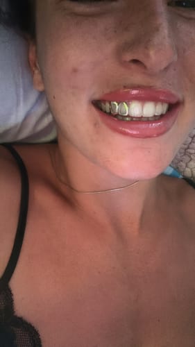 Customer photo review of BLAZE (SILVER GRILLZ)