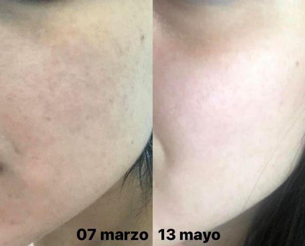 Customer photo review of Loción limpiadora facial