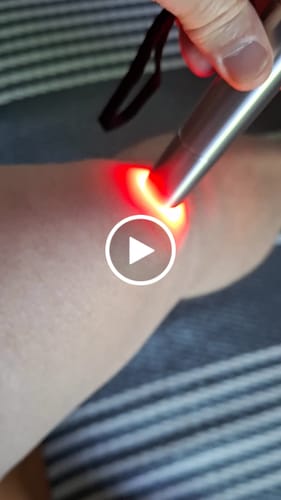 Customer video review of ClinicRed Fototerápiás Eszköz