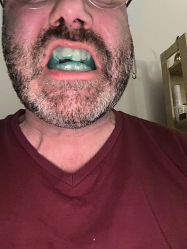 Customer photo review of SleepPro Custom AM