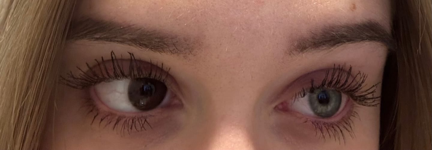Customer photo review of Eyeling Custom Lens (1 month)