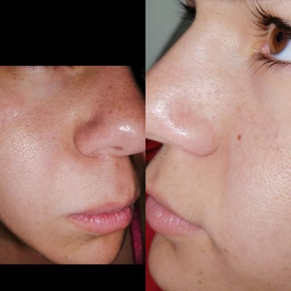 Customer photo review of Loción limpiadora facial