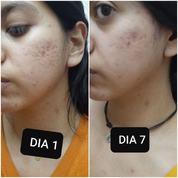Customer photo review of Loción limpiadora facial