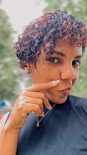 Customer photo review of Anti-Acne & Dark Spots African Soap