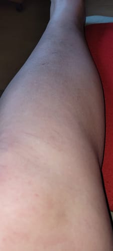 Customer photo review of 3x Belle Body Haarentfernung