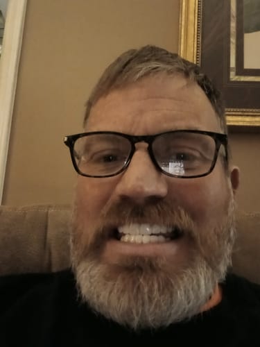 Customer photo review of Teeth-Veneer 2.0