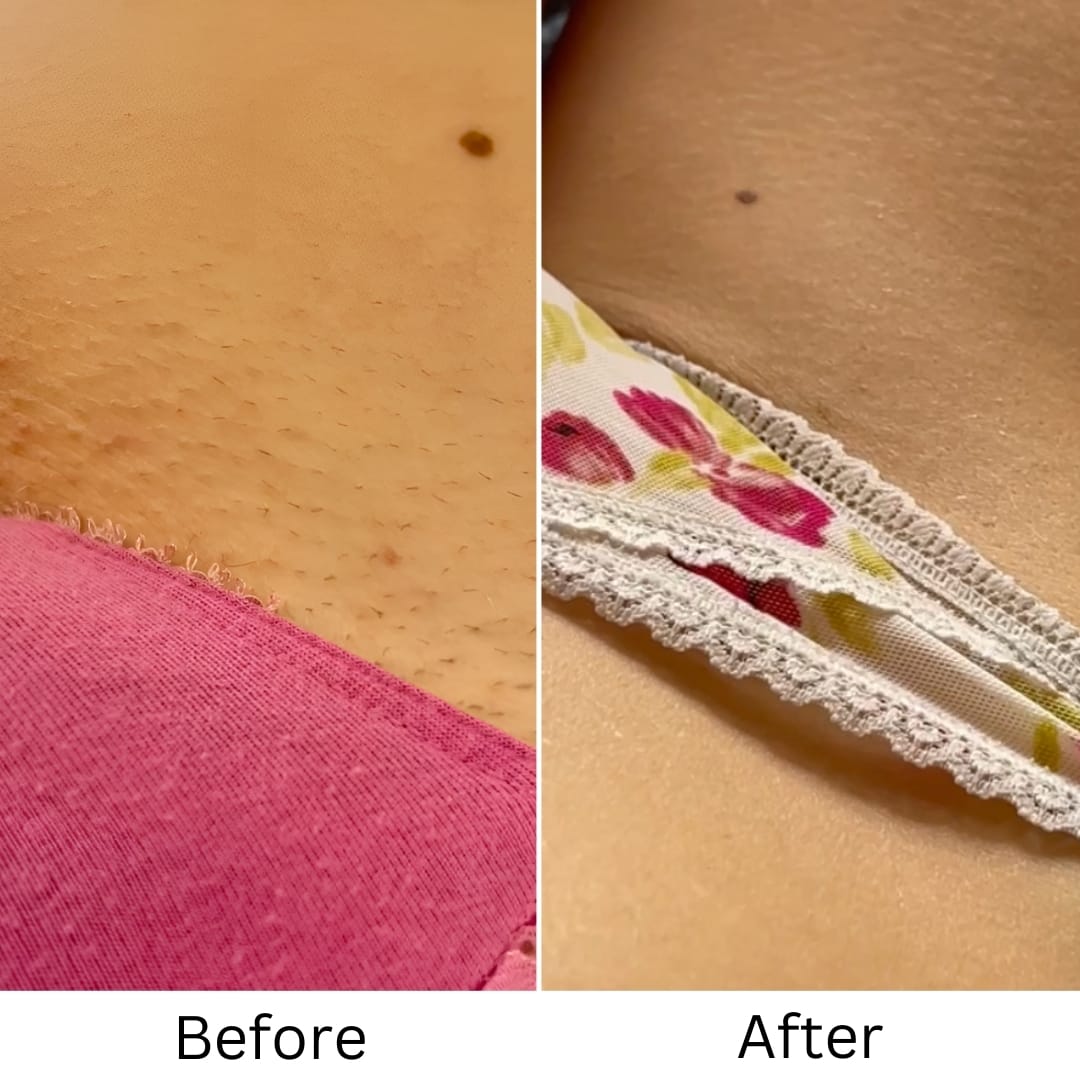 Customer photo review of Probiotic Intimate Duo