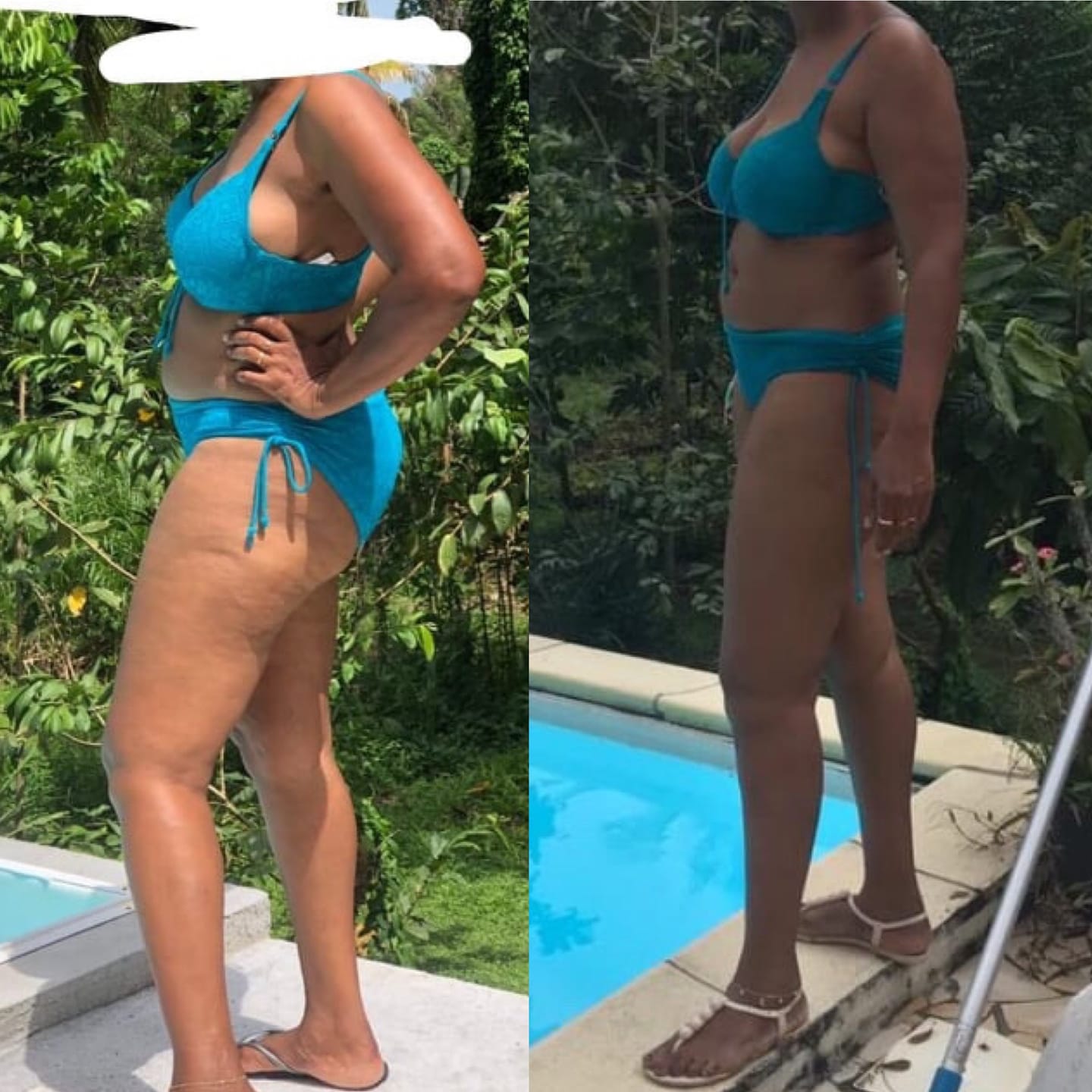 Customer photo review of Gel Minceur™