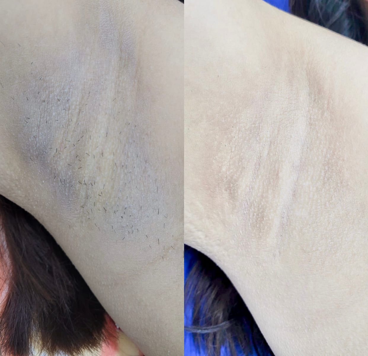 Customer photo review of Loción limpiadora facial