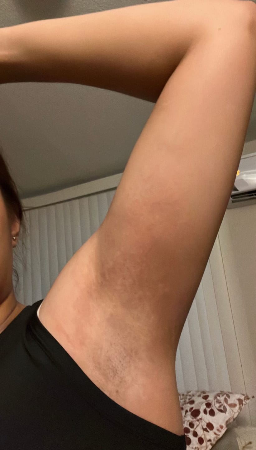Customer photo review of Loción limpiadora facial