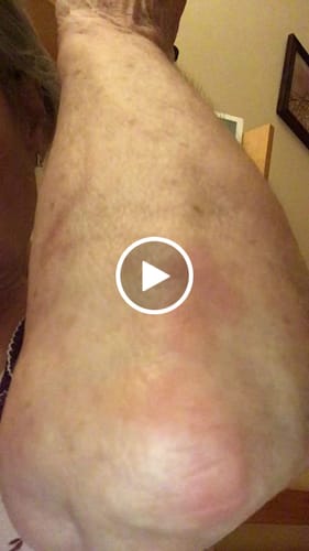 Customer video review of Sereni Pikkelysömör és Ekcéma Krém