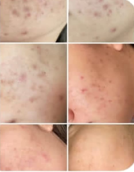 Customer photo review of Loción limpiadora facial