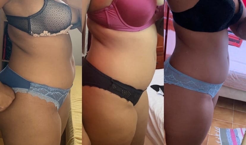 Customer photo review of Gel Minceur™