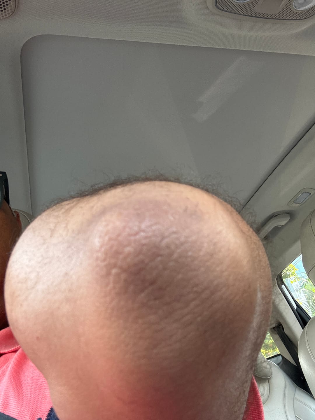 Customer photo review of EXFOLIATING Peel Appeal Serum 30 ml