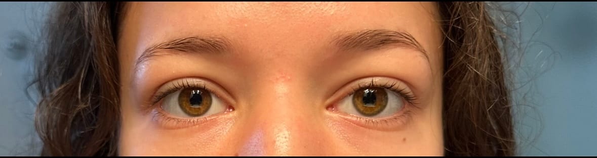 Customer photo review of PERFECT DUO BUNDLE