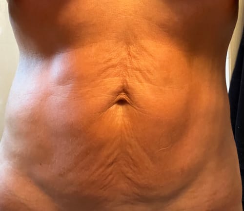 Customer photo review of Magic Body Oil - 100ml