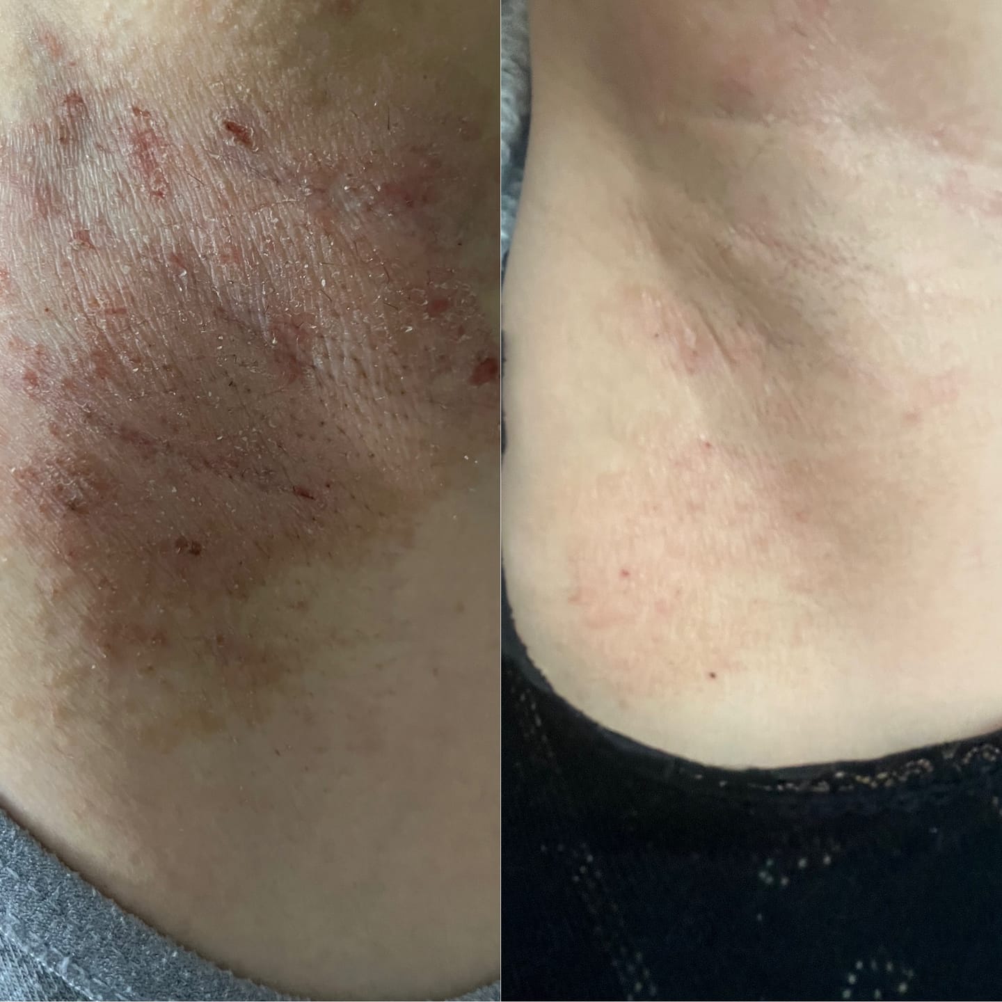 Customer photo review of Remedium Vücut Losyonu