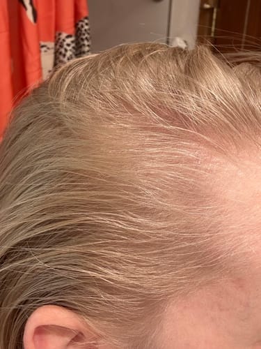 Customer photo review of Hair Plumping Serum