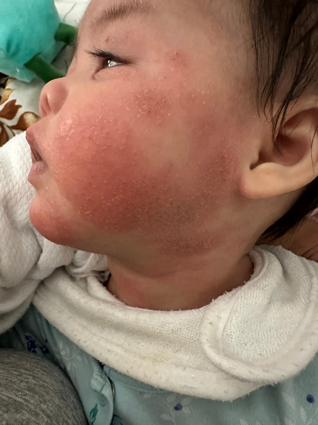 Customer photo review of Baby Balm