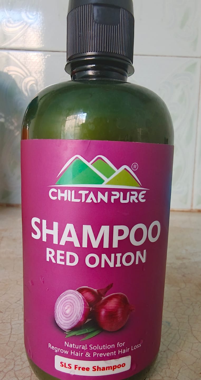 Customer photo review of Red Onion Shampoo 🧅 Natural Solution for Regrow Hair & Prevent Hair Loss 100% Results