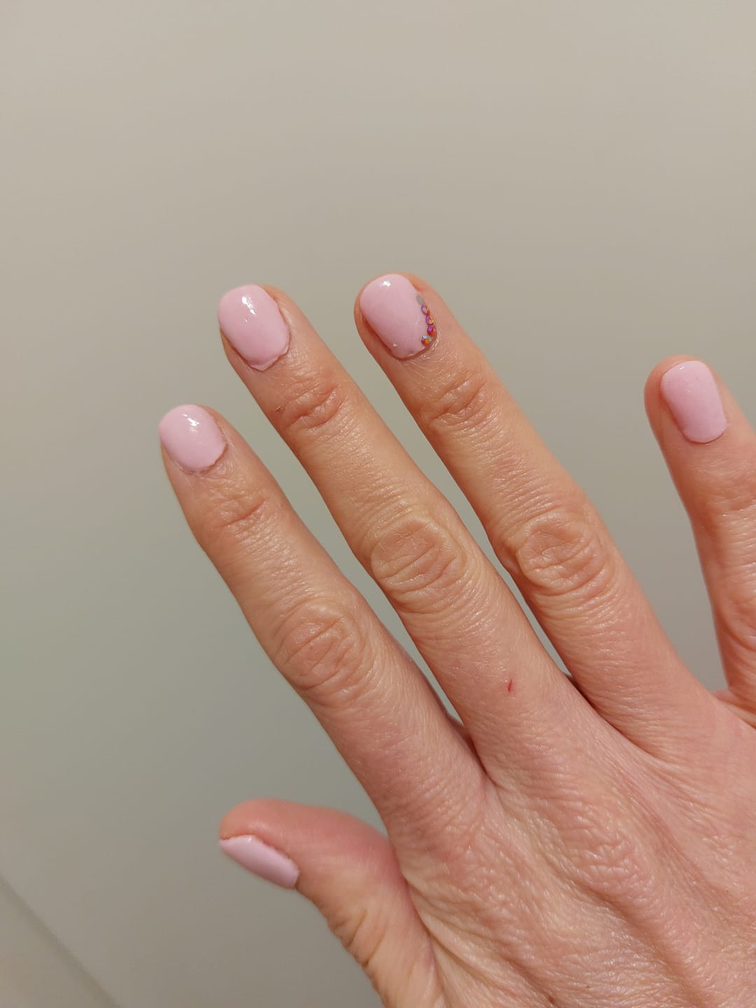 Customer photo review of Basis Accessoires Set