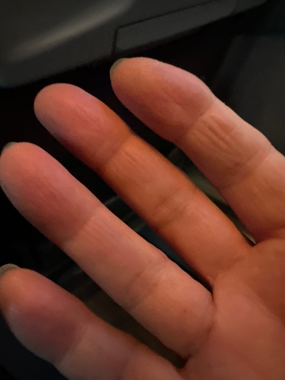 Reseña fotográfica de un cliente sobre Manos suaves - con rosa y raíz de rosa