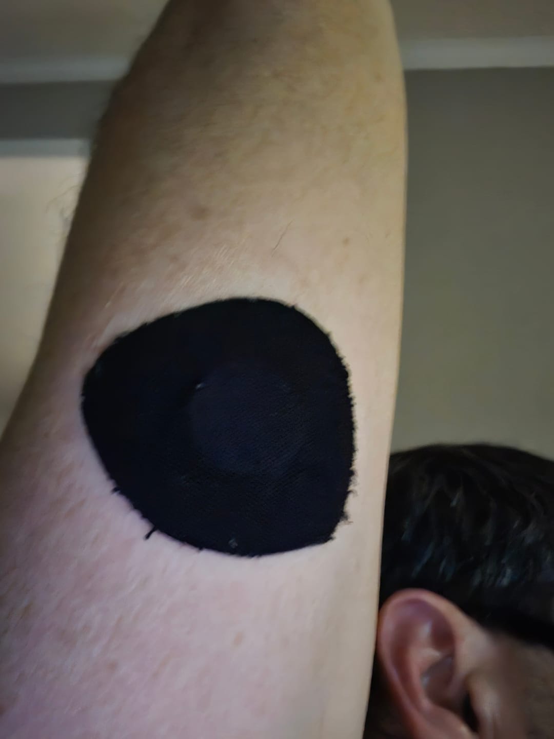 Customer photo review of Skin Grip Original - Libre 3 Adhesive Patches