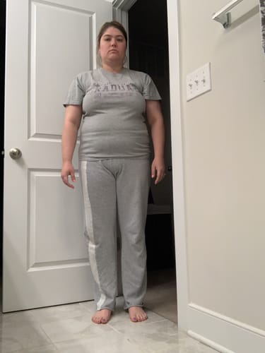 Customer photo review of Semaglutide Weight Loss Program