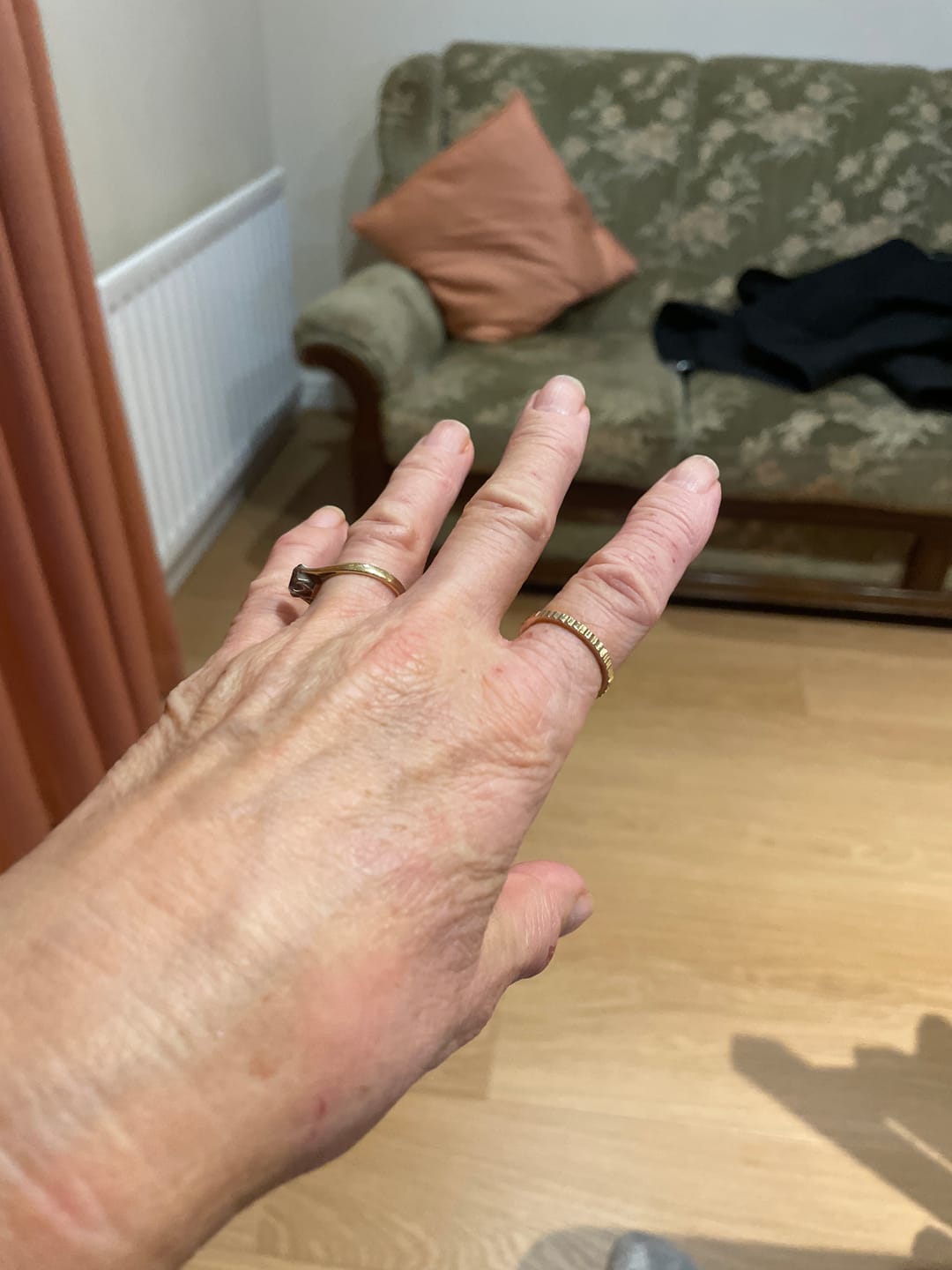 Customer photo review of Mini Pleat Slim Ring