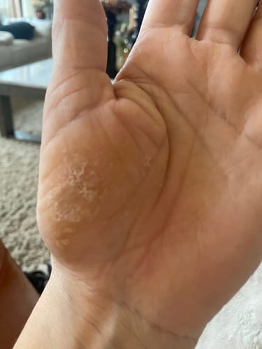 Customer photo review of Neptune Grass Fed Tallow & Honey Balm