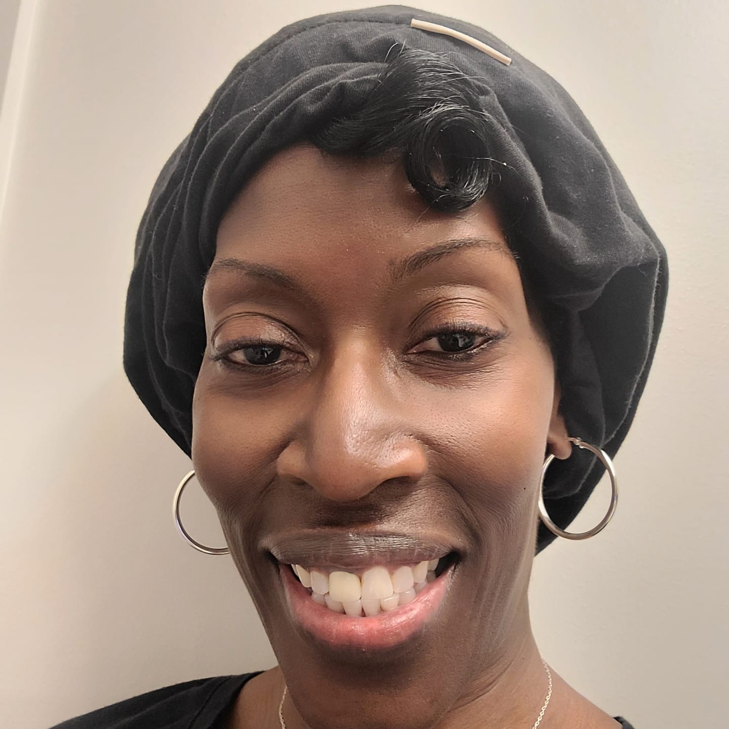Customer photo review of Astro Brand Facial Bar - Nature's Radiance Infusion