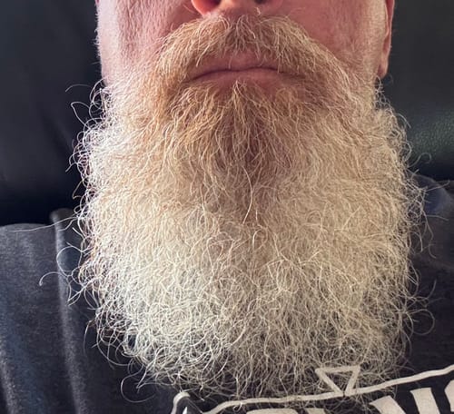Danny&rsquo;s progress photo