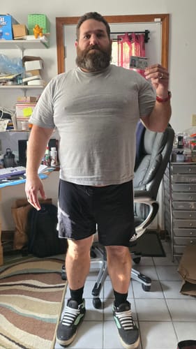 Customer photo review of Tirzepatide Weight Loss Program