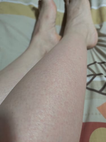 Customer photo review of Depilador Nano Pro