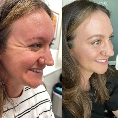 Customer photo review of Luminous Face Lift Bundle - Sale