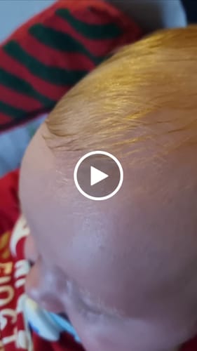 Customer video review of Sensitive Scalp Set