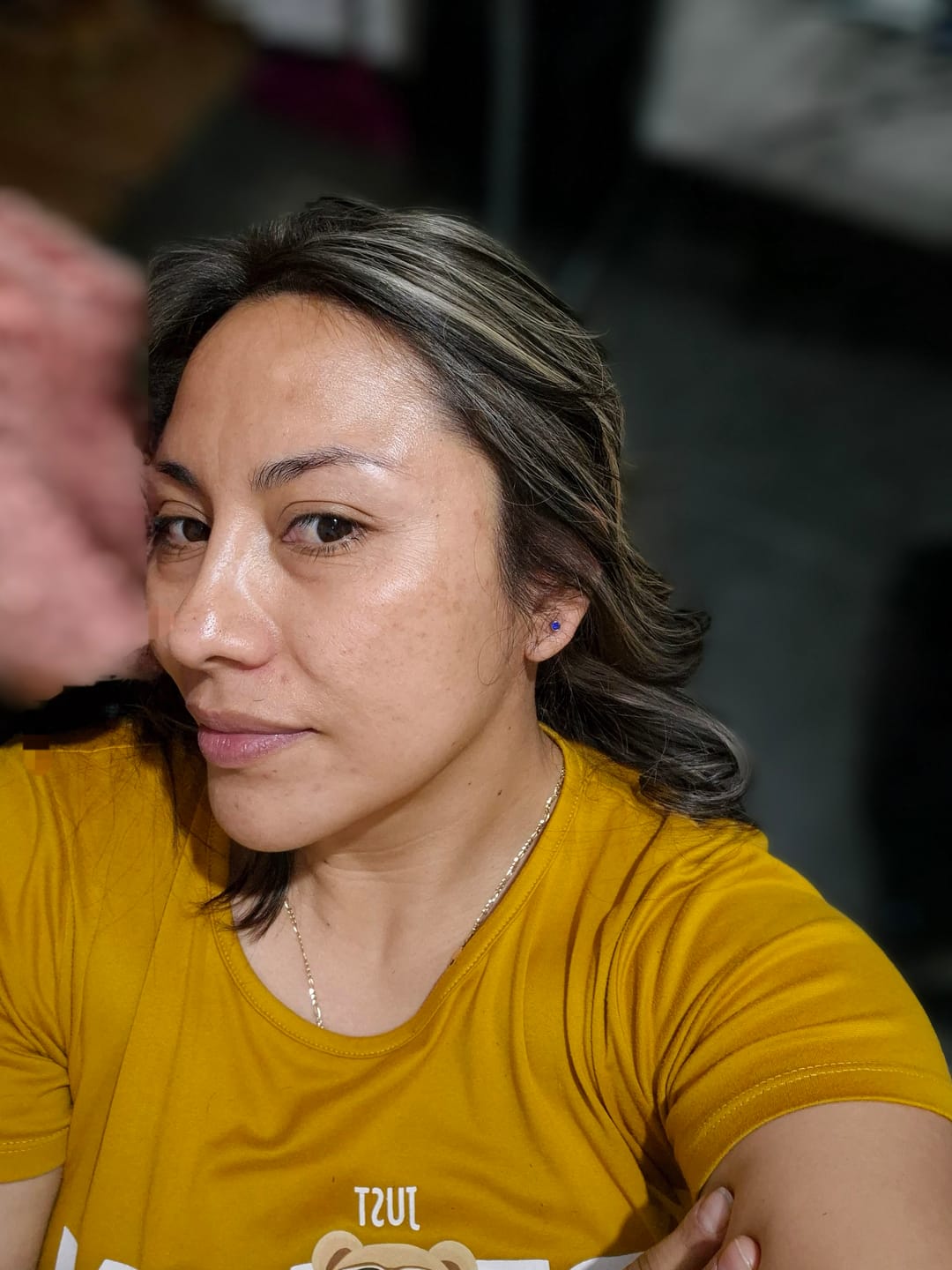 Customer photo review of Kit Piel Deslumbrante (51% OFF) - Limpiador + Tónico + Serum Vitamina C + Serum Niacinamida + Serum Ácido Glicólico + Serum Ácido Hialurónico + Contorno de Ojos